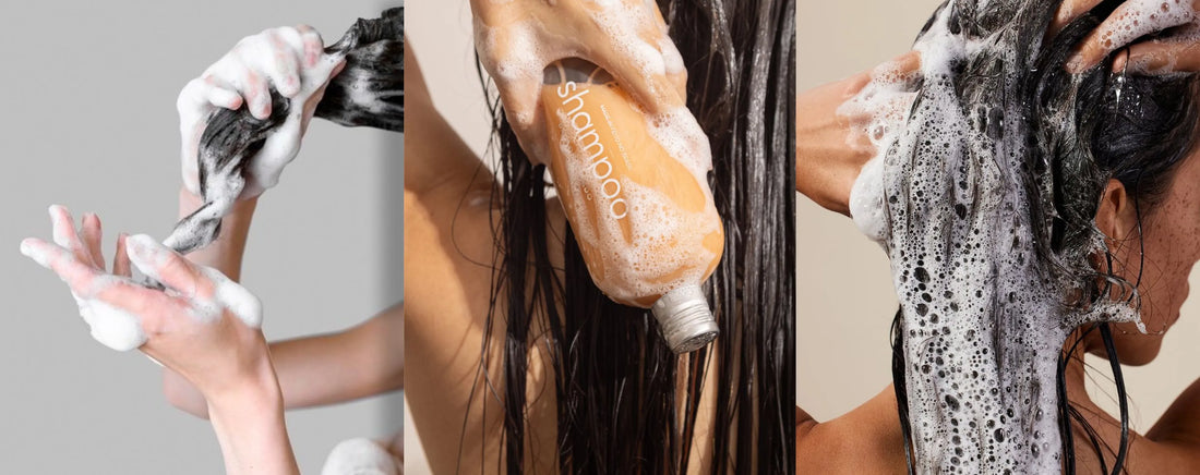 The Glucoside Paradigm: Re-Engineering Scalp Homeostasis via Non-Stripping Botanical Surfactants