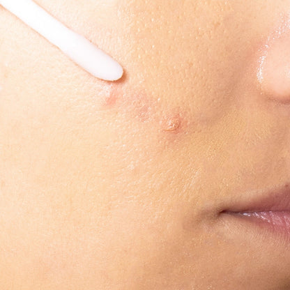 Soin clear anti-imperfections
