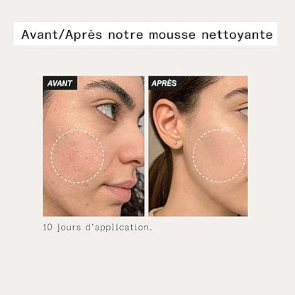 Aloe Paris Gentle Cleansing Foam – 100 ml
