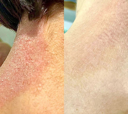 Derma Douce  Plus 15% d'urée