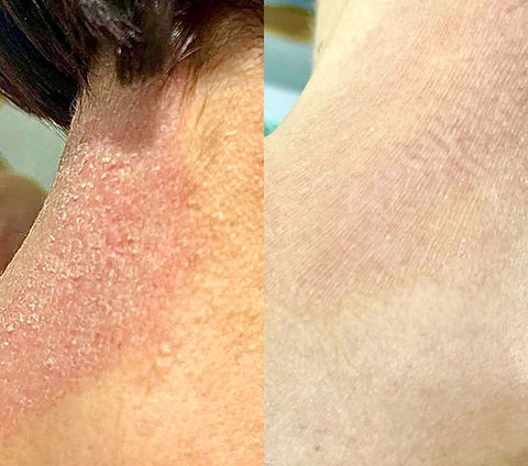 Derma Douce  Plus 15% d'urée