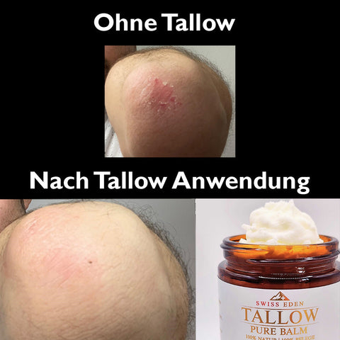 Schweizer Tallow Balm Vanille und Honig – aus Bio  Weidetalg von Swiss Eden